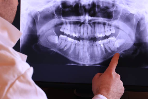 Best Emergency Treatment for Toothache in Iona, ID